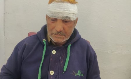 जमीनी विवाद में मारपीट, नवविवाहिता समेत तीन घायल