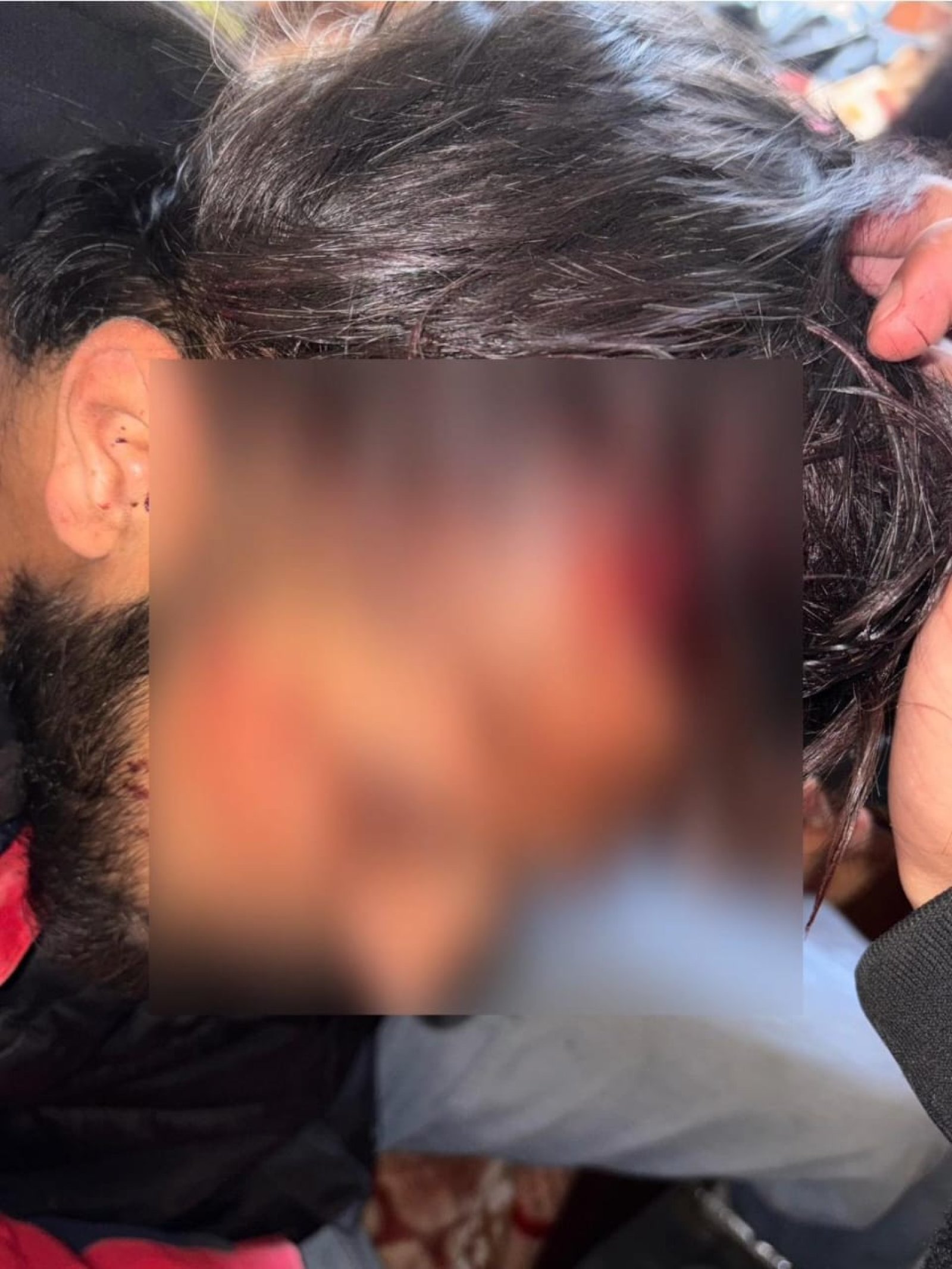 एचपीयू कैंपस में भिड़े छात्र संगठन, तेजधार हथियारों से किया हमला