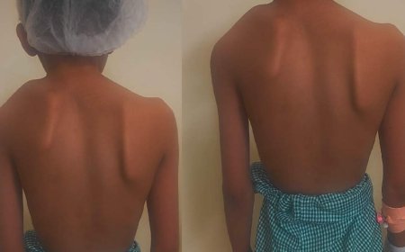 टांडा मेडिकल कॉलेज में पहली बार दुर्लभ कंधा सर्जरी सफल