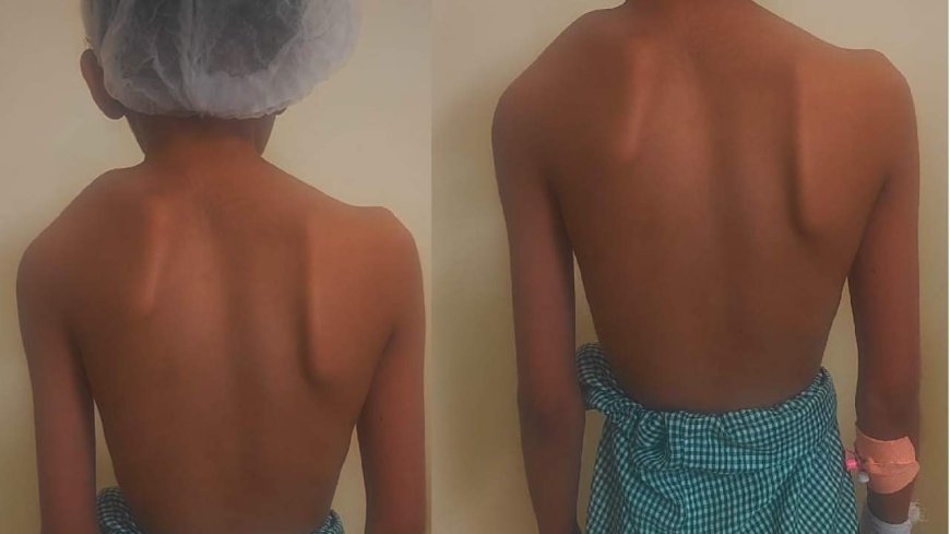 टांडा मेडिकल कॉलेज में पहली बार दुर्लभ कंधा सर्जरी सफल