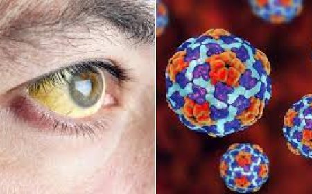 मंडी के गोहर में पीलिया के मरीजों का आंकड़ा पहुंचा 82, जलस्रोतों को गंदा करने वाले 10 लोगों को नोटिस जारी