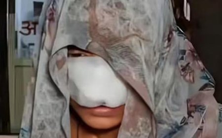 हमीरपुर (UP) में हैवानियत: मामूली विवाद में पत्नी की नाक चबा गया पति