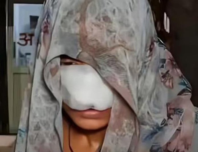 हमीरपुर (UP) में हैवानियत: मामूली विवाद में पत्नी की नाक चबा गया पति