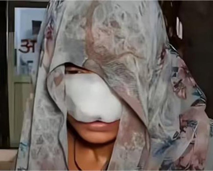 हमीरपुर (UP) में हैवानियत: मामूली विवाद में पत्नी की नाक चबा गया पति